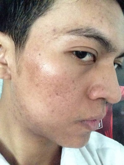 La Grace Clinic เซ็นทรัลเวิลด์