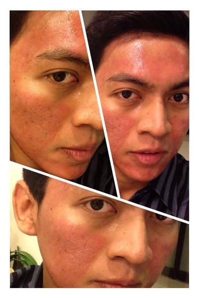 La Grace Clinic เซ็นทรัลเวิลด์