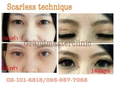 แกรนด์มาสเตอร์ คลินิก (Grandmaster Clinic) แกรนด์มาสเตอร์ คลินิก (Grandmaster Clinic)