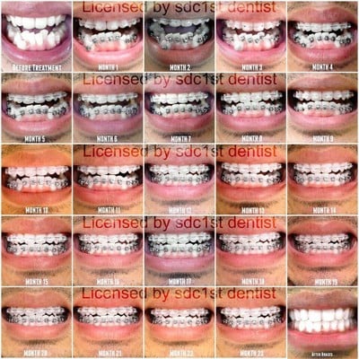 ศาลาแดง ซ.1 ทันตกรรม (SDC1st Dentist) ศาลาแดง ซ.1 ทันตกรรม (SDC1st Dentist)