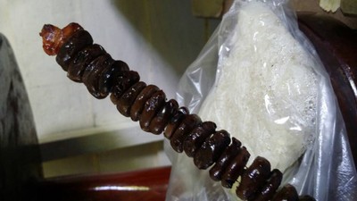 ตับอ่อน ขั้วตับ