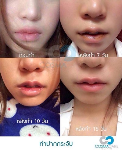 Cosmacare Clinic เลียบทางด่วนรามอินทรา(นวลจันทร์) , ทองหล่อ ซอย 5 , สยามซอย 9 , โลตัส - ศรีนครินทร์ , คริสตัลพาร์ค - เลียบทางด่วนรามอินทรา , โลตัส - วังหิน Cosmacare Clinic เลียบทางด่วนรามอินทรา(นวลจันทร์) , ทองหล่อ ซอย 5 , สยามซอย 9 , โลตัส - ศรีนครินทร์ , คริสตัลพาร์ค - เลียบทางด่วนรามอินทรา , โลตัส - วังหิน