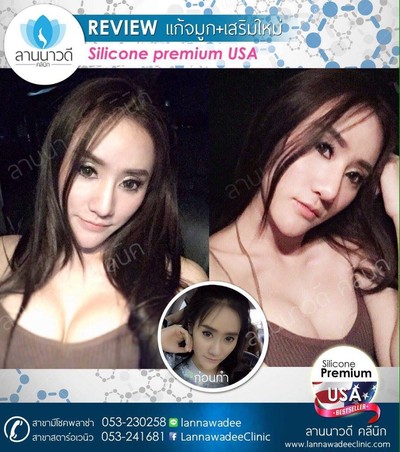 ลานนาวดีคลีนิค มีโชคพลาซ่า