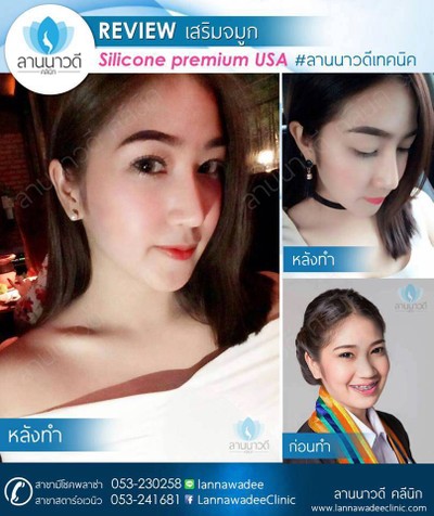 ลานนาวดีคลีนิค มีโชคพลาซ่า