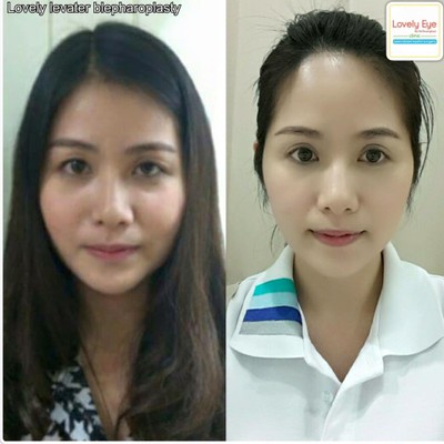 Lovely Eye and Skin Clinic (เลิฟลี่อาย คลินิก) Lovely Eye and Skin Clinic (เลิฟลี่อาย คลินิก)