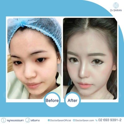 หมอศรัณย์ (คลินิกศัลยกรรมนายแพทย์ศรัณย์) (หมอศรัณย์ คลินิก) หมอศรัณย์ (คลินิกศัลยกรรมนายแพทย์ศรัณย์) (หมอศรัณย์ คลินิก)