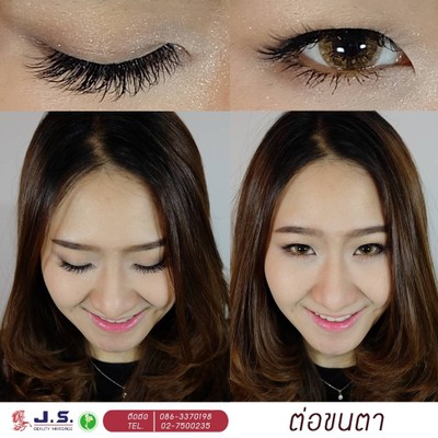 J.S Beauty Massage Center (เจเอส บิวตี้ มาสสาจ เซ็นเตอร์) กิ่งแก้ว J.S Beauty Massage Center (เจเอส บิวตี้ มาสสาจ เซ็นเตอร์) กิ่งแก้ว