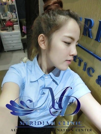 เมอริเดียน คลีนิก นิมมานเหมินทร์