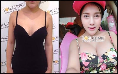 Mew Clinic ศัลยกรรม เชียงใหม่  เชียงใหม่