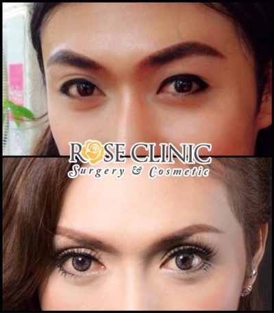 Mew Clinic ศัลยกรรม เชียงใหม่  เชียงใหม่