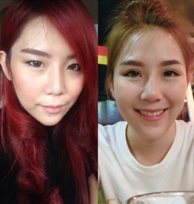 อีสต์ คลินิก - East Clinic เชียงใหม่ คลองชลประทาน