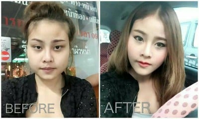 เชียงใหม่ศัลยกรรม