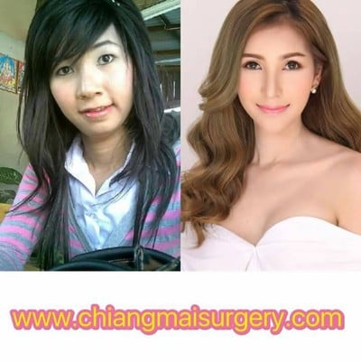 เชียงใหม่ศัลยกรรม
