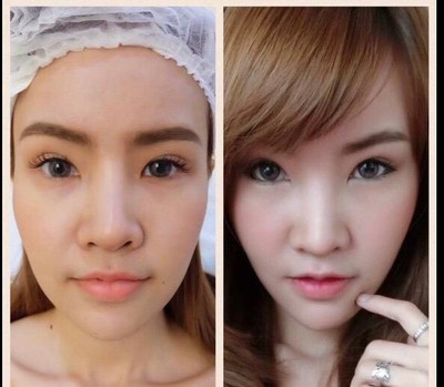 Napassaree Clinic (นภัสรีย์คลินิก) อ่อนนุช Napassaree Clinic (นภัสรีย์คลินิก) อ่อนนุช