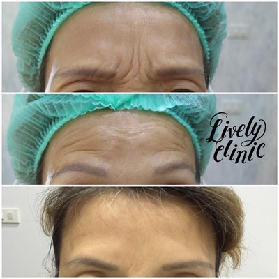 Lively Clinic (ไลฟ์ลี่ คลีนิก) สุขุมวิท 39 Lively Clinic (ไลฟ์ลี่ คลีนิก) สุขุมวิท 39