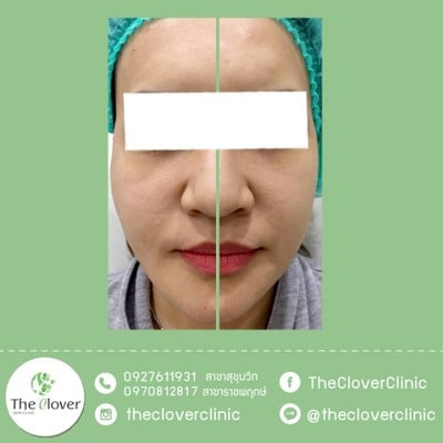 The Clover Clinic Siam Square One The Clover Clinic Siam Square One