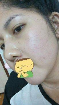 เราเอง