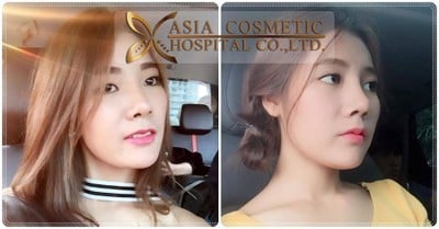 Asia Cosmetic Hospital
