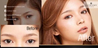 Luxury Clinic เซนทรัลปิ่นเกล้า