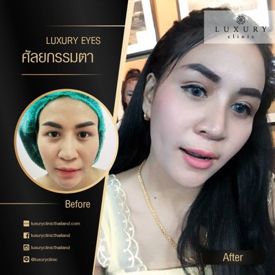Luxury Clinic เซนทรัลปิ่นเกล้า