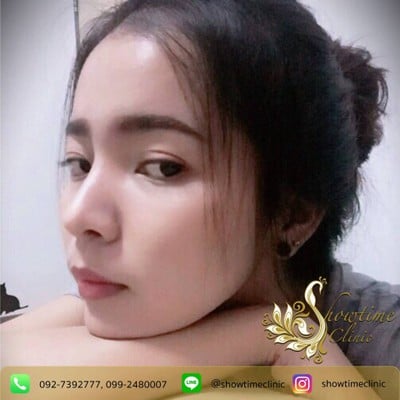 Showtime Clinic รัชดา