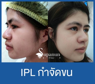 บริการหรือผลลัพธ์ที่ได้