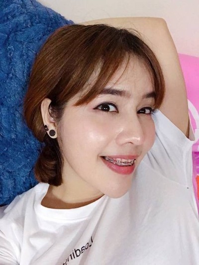 เสริมเสริมกระดูกอ่อนหลังหู