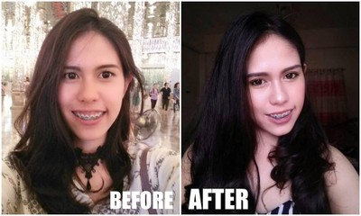 เปรียบเทียบก่อน-หลัง