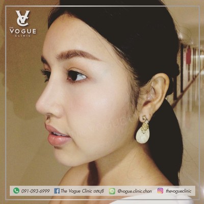 The VOGUE Clinic (เดอะโว้กคลินิก) ชลบุรี The VOGUE Clinic (เดอะโว้กคลินิก) ชลบุรี
