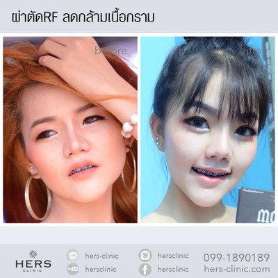 Hers Clinic (เฮอร์สคลินิก) Hers Clinic (เฮอร์สคลินิก)
