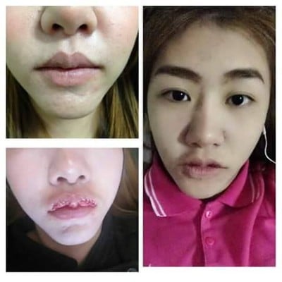 เชียงใหม่ศัลยกรรม