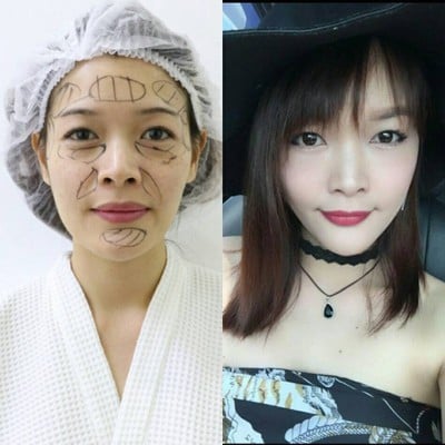 Haeyo Clinic the street รัชดา Haeyo Clinic the street รัชดา