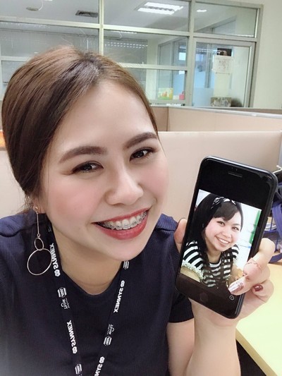 V Square Clinic Botox Filler Center เดอะวอล์คเกษตรนวมินทร์