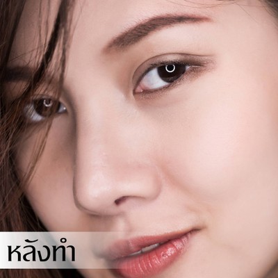 Ametise Clinic (อเมทิส คลินิก) Sathon Soi 1 Ametise Clinic (อเมทิส คลินิก) Sathon Soi 1