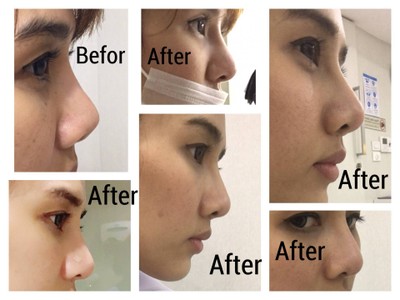 SLC Siam Laser Clinic (สยามเลเซอร์ คลินิก) ทองหล่อ SLC Siam Laser Clinic (สยามเลเซอร์ คลินิก) ทองหล่อ