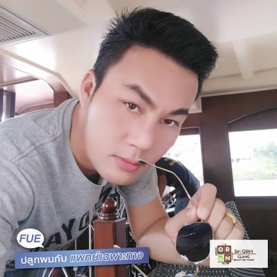 Dr.ORN Hair transplant center