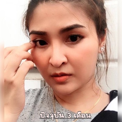 บริการหรือผลลัพธ์ที่ได้