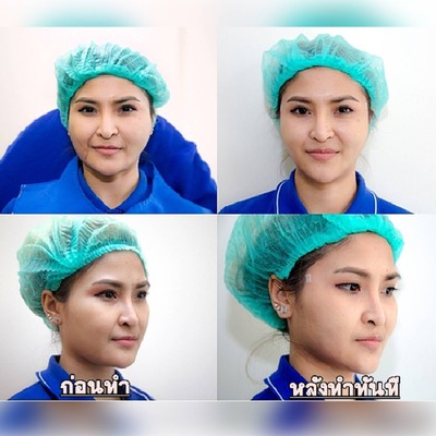 บริการหรือผลลัพธ์ที่ได้