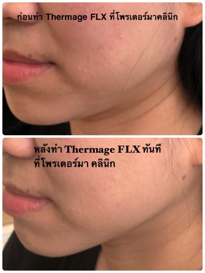 Proderma (โพรเดอร์มาคลินิก) Proderma (โพรเดอร์มาคลินิก)