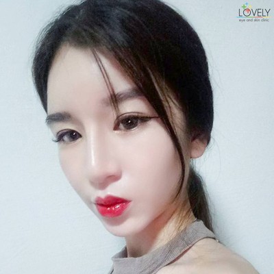 Lovely Eye and Skin Clinic พาร์คเลนเอกมัย