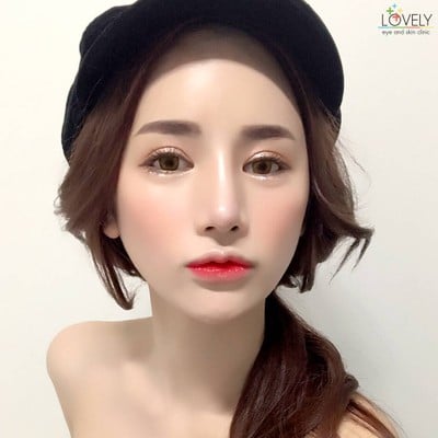 Lovely Eye and Skin Clinic พาร์คเลนเอกมัย