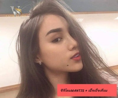 VVER CLINIC ปิ่นเกล้า