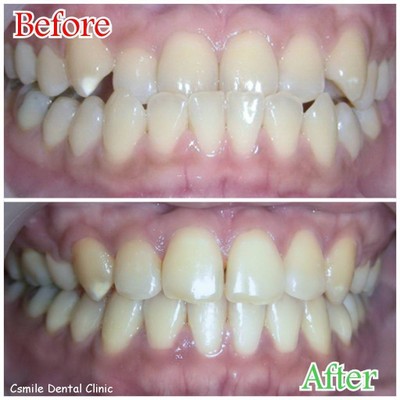 บริการหรือผลลัพธ์ที่ได้