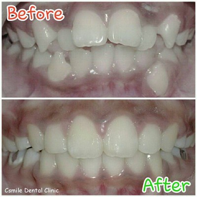 บริการหรือผลลัพธ์ที่ได้