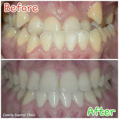 บริการหรือผลลัพธ์ที่ได้