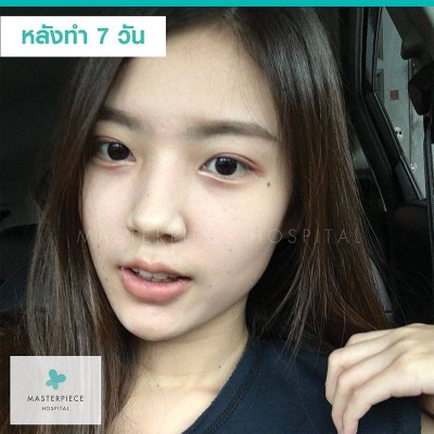 โรงพยาบาลมาสเตอร์พีช