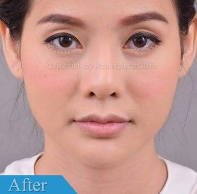 โรงพยาบาลมาสเตอร์พีช