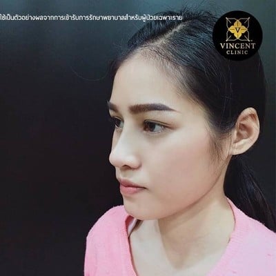 Vincent Clinic  อมตะนคร