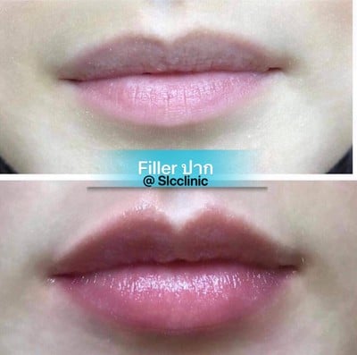 SLC Siam Laser Clinic เซ็นทรัลเฟสติวัล อีสต์วิลล์