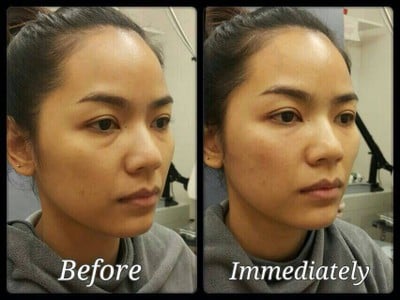 Slc Siam Laser Clinic (สยามเลเซอร์คลินิก) ซีคอนสแควร์ Slc Siam Laser Clinic (สยามเลเซอร์คลินิก) ซีคอนสแควร์